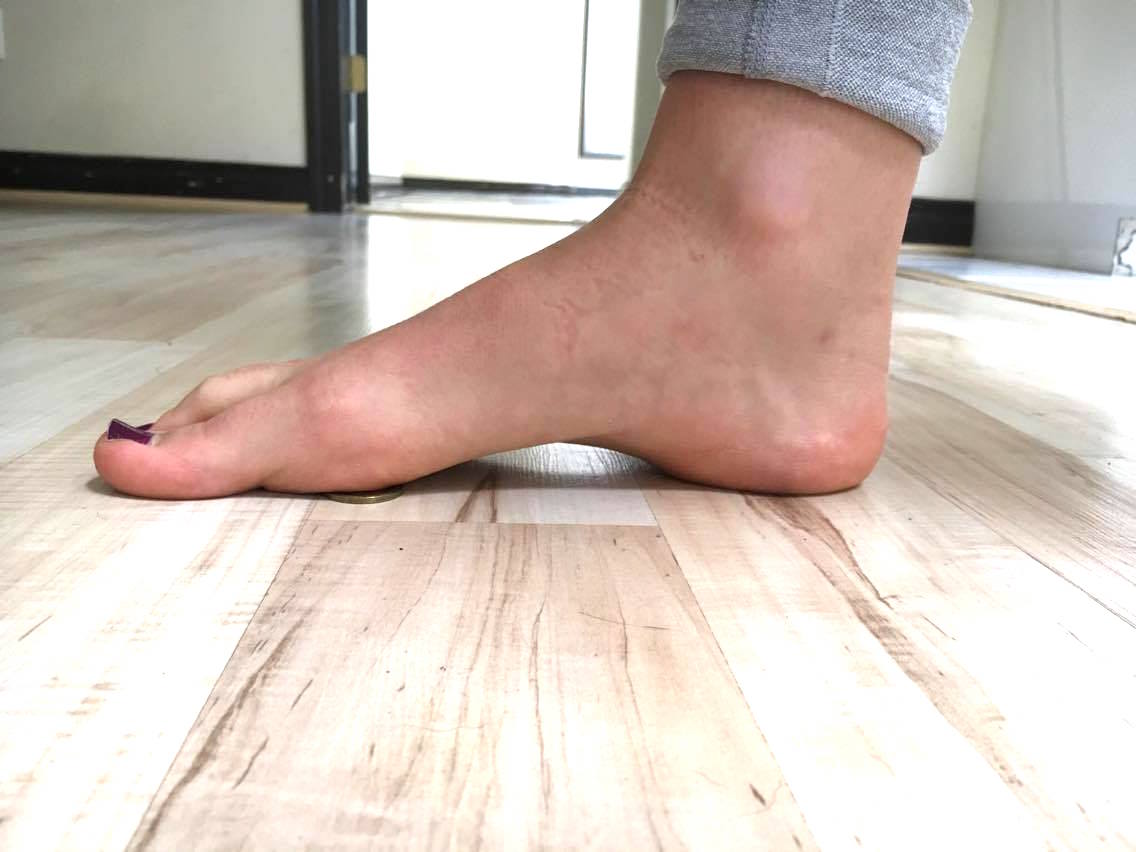 How to Fix Flat Feet with Exercise